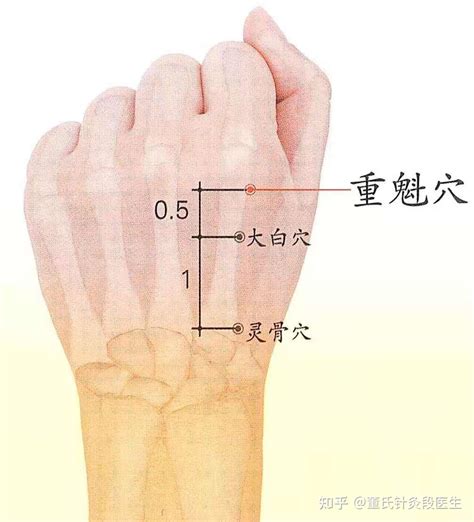 重魁穴|董氏奇穴针灸：灵骨穴 l 大白穴 l 重魁穴「穴位讲解」